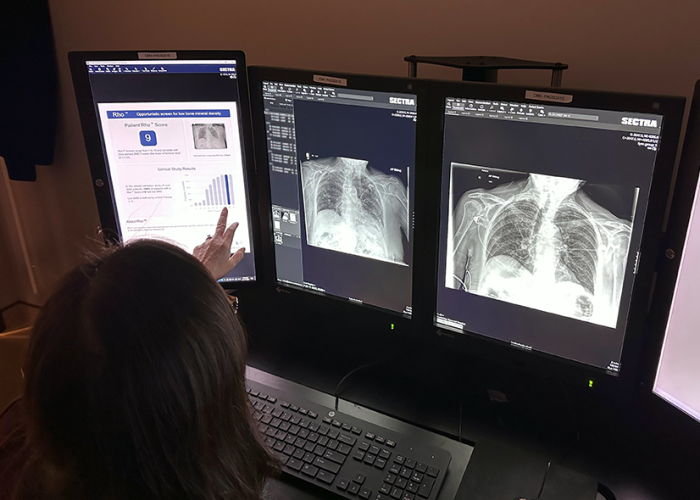 radiologist looking over x ray